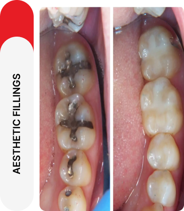 erwyadvcbs asthatic